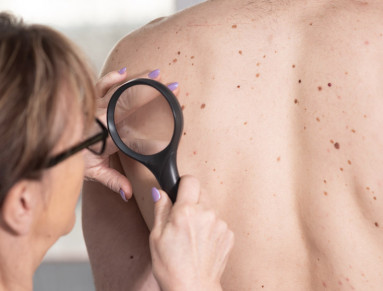 Une dermatologue examine la peau d’une jeune fille.