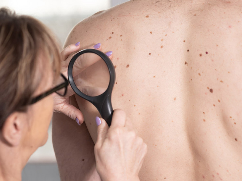 Une dermatologue examine la peau d’une jeune fille.